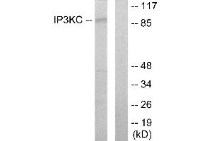 Western blot analysis of extracts from HT-29 cells, using IP3KC antibody. (ITPKC Antikörper)