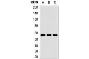 Western blot analysis of Cytokeratin 4 expression in HEK293T (A), Raw264. (KRT4 Antikörper  (Center))