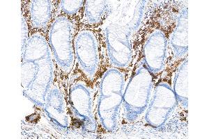 Immunohistochemistry (IHC) image for anti-CD38 (AA 43-300) antibody (ABIN7453961) (Rekombinanter CD38 Antikörper  (AA 43-300))