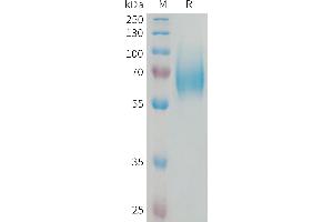 SDS-PAGE (SDS) image for Fibroblast Growth Factor Receptor 1 (FGFR1) (AA 22-376) protein (His tag) (ABIN7538233)