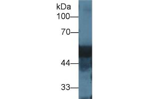 Western blot analysis of Rat Liver lysate, using Rat DBP Antibody (1 µg/ml) and HRP-conjugated Goat Anti-Rabbit antibody ( (Vitamin D-Binding Protein Antikörper  (AA 395-475))