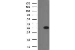 Image no. 1 for anti-RING1 and YY1 Binding Protein (RYBP) antibody (ABIN1500776) (RYBP Antikörper)
