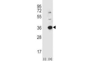 Western blot analysis using anti-Caspase-3 antibody and 293 cell lysate (2 ug/lane) either nontransfected (Lane 1) or transiently transfected (2) with the CASP3 gene.