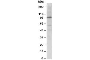 Western blot testing of Cullin 4B antibody and rat lung tissue lysate (Cullin 4B Antikörper  (C-Term))