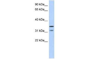 C17ORF81 antibody used at 1 ug/ml to detect target protein. (Retinoic Acid Induced 12 (RAI12) (Middle Region) Antikörper)