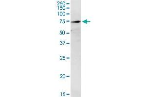 TREH monoclonal antibody (M02), clone 2D10. (TREH Antikörper  (AA 25-124))