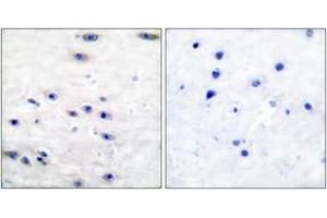 Immunohistochemistry analysis of paraffin-embedded human brain tissue, using Tyrosine Hydroxylase (Ab-19) Antibody. (Tyrosine Hydroxylase Antikörper  (AA 10-59))