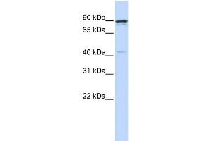 WB Suggested Anti-CCNT1 Antibody Titration:  0.