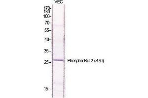 Western Blot (WB) analysis of specific cells using Phospho-Bcl-2 (S70) Polyclonal Antibody. (Bcl-2 Antikörper  (pSer70))
