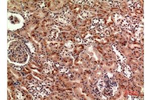 Immunohistochemistry (IHC) analysis of paraffin-embedded Human Kidney, antibody was diluted at 1:100. (CER1 Antikörper  (Internal Region))