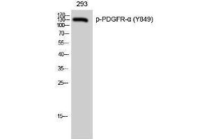 Western Blotting (WB) image for anti-Platelet Derived Growth Factor Receptor alpha (PDGFRA) (pTyr849) antibody (ABIN3179569) (PDGFRA Antikörper  (pTyr849))