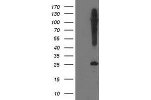 Western Blotting (WB) image for anti-Synaptosomal-Associated Protein, 25kDa (SNAP25) antibody (ABIN1501015) (SNAP25 Antikörper)