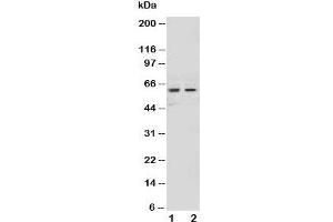 Western blot testing of NOX1 antibody and Lane 1:  HeLa;  2: MCF-7 cell lysate (NOX1 Antikörper  (AA 354-374))