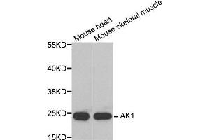 Western blot analysis of extracts of various tissues, using AK1 antibody. (Adenylate Kinase 1 Antikörper  (AA 1-194))