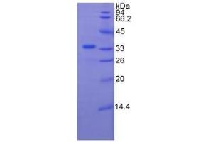SDS-PAGE analysis of Human Plexin B1 Protein.