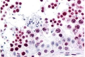 Human Testis: Formalin-Fixed, Paraffin-Embedded (FFPE) (HMGB1 Antikörper  (AA 1-216))