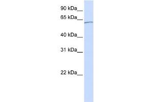 WB Suggested Anti-KPNA5 Antibody Titration: 0. (KPNA5 Antikörper  (C-Term))