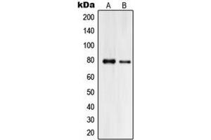 Western blot analysis of Praja2 expression in HeLa (A), HL60 (B) whole cell lysates. (PJA2 Antikörper  (Center))
