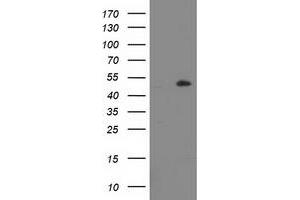 Western Blotting (WB) image for anti-Lipoprotein Lipase (LPL) (AA 28-475) antibody (ABIN1491317) (Lipoprotein Lipase Antikörper  (AA 28-475))