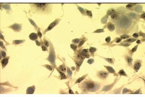 Image no. 3 for anti-Heat Shock Protein 70 (HSP70) (AA 436-503) antibody (ABIN466875) (HSP70 Antikörper  (AA 436-503))