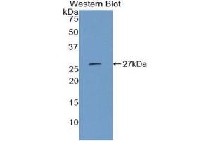 Detection of Recombinant CTH, Mouse using Polyclonal Antibody to Cystathionine (CTH) (Cystathionine (AA 14-224) Antikörper)