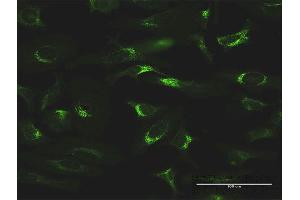Immunofluorescence of monoclonal antibody to FTL on HeLa cell. (FTL Antikörper  (AA 1-175))
