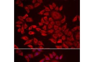 Immunofluorescence analysis of HeLa cells using AGPAT2 Polyclonal Antibody (AGPAT2 Antikörper)