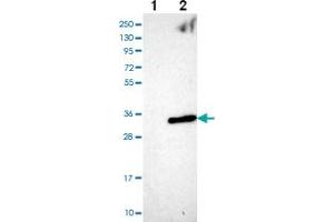 Western blot analysis of Lane 1: Negative control (vector only transfected HEK293T lysate) Lane 2: Over-expression Lysate (Co-expressed with a C-terminal myc-DDK tag (~3. (ANKRD46 Antikörper)