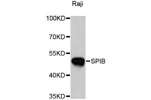 Western blot analysis of extracts of Raji cells, using SPIB antibody. (SPIB Antikörper)