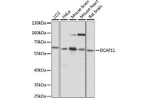 Western blot analysis of extracts of various cell lines, using DC antibody (ABIN7266680) at 1:1000 dilution. (DCAF11 Antikörper  (AA 1-170))