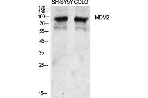 Western Blot (WB) analysis of specific cells using MDM2 Polyclonal Antibody. (MDM2 Antikörper  (Ser880))