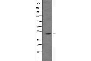 Western blot analysis of OR51E2 Antibody expression in JK cells lysates. (PSGR Antikörper  (Internal Region))