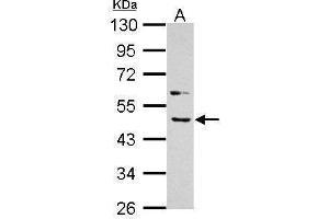 WB Image Sample (30 ug of whole cell lysate) A: A431 10% SDS PAGE antibody diluted at 1:1000 (BMP4 Antikörper  (C-Term))
