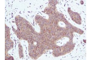 Image no. 2 for anti-Chemokine (C-X-C Motif) Ligand 10 (CXCL10) antibody (ABIN465011) (CXCL10 Antikörper)