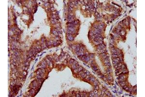Immunohistochemistry (IHC) image for anti-Brain and Reproductive Organ-Expressed (TNFRSF1A Modulator) (BRE) (AA 94-383) antibody (ABIN7145788)