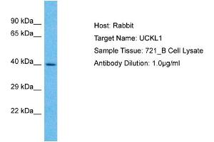 Host: Rabbit Target Name: UCKL1 Sample Type: 721_B Whole cell lysates Antibody Dilution: 1. (UCKL1 Antikörper  (N-Term))
