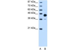 Western Blotting (WB) image for anti-Homeobox C10 (HOXC10) antibody (ABIN2461879) (HOXC10 Antikörper)