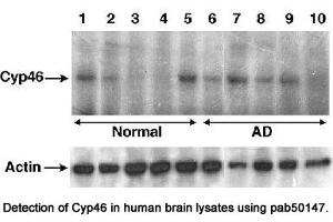 Image no. 1 for anti-Cytochrome P450, Family 46, Subfamily A, Polypeptide 1 (CYP46A1) antibody (ABIN363456) (CYP46A1 Antikörper)