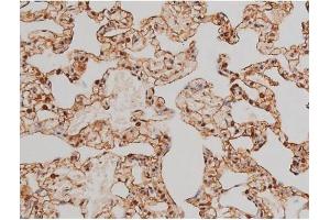 ABIN6267433 at 1/200 staining Rat lung tissue sections by IHC-P.