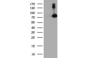 Western Blotting (WB) image for anti-F-Box Protein 21 (FBXO21) antibody (ABIN1498236) (FBXO21 Antikörper)