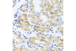 Immunohistochemistry of paraffin-embedded human stomach using INADL antibody at dilution of 1:100 (x40 lens). (PATJ Antikörper)