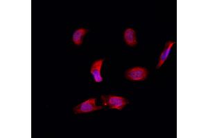 ABIN6257639 and ABIN6274782 staining Hela by IF/ICC.