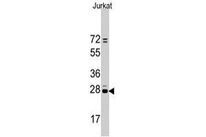 Western blot analysis of CD9 polyclonal antibody  in Jurkat cell line lysates (35 ug/lane). (CD9 Antikörper  (N-Term))