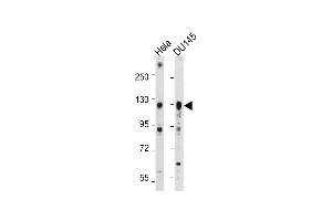 All lanes : Anti-AXL Antibody at 1:2000 dilution Lane 1: Hela whole cell lysate Lane 2: D whole cell lysate Lysates/proteins at 20 μg per lane. (AXL Antikörper)