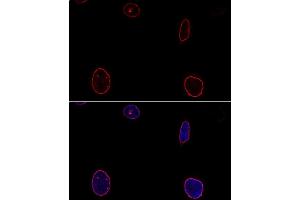 Confocal immunofluorescence analysis of U-2OS cells using Emerin/Emerin/EMD antibody  at dilution of 1:100. (Emerin Antikörper  (AA 1-220))