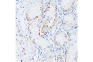 Immunohistochemistry of paraffin-embedded Rat kidney using GTPBP8 Rabbit pAb (ABIN7267527) at dilution of 1:100 (40x lens). (GTPBP8 Antikörper  (AA 1-170))