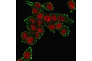 Immunofluorescence staining of HePG2 cells using TNF alpha Mouse Monoclonal Antibody (TNF706) followed by goat anti-mouse IgG-CF488 (green). (TNF alpha Antikörper  (N-Term))