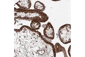 Immunohistochemical staining of human placenta with HGSNAT polyclonal antibody  shows strong cytoplasmic positivity in trophoblastic cells. (HGSNAT Antikörper)