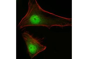 Immunofluorescence (IF) image for anti-Signal Transducer and Activator of Transcription 1, 91kDa (STAT1) (AA 717-745), (C-Term) antibody (ABIN1881847)
