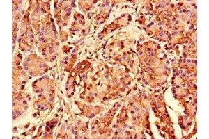 Immunohistochemistry of paraffin-embedded human pancreatic tissue using ABIN7142536 at dilution of 1:100 (RPS26 Antikörper  (AA 2-115))